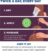 Regaine  Hair Regrowth Treatment for Women, 2 Ounce